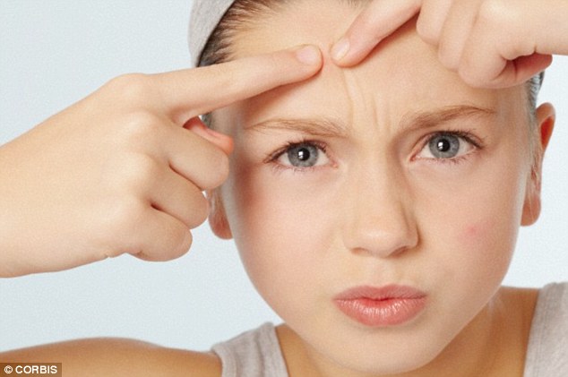How Do You Get Rid Of Forehead Acne