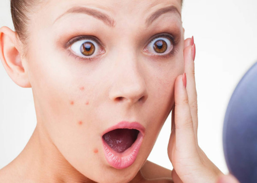 How Do You Treat Blind Pimples