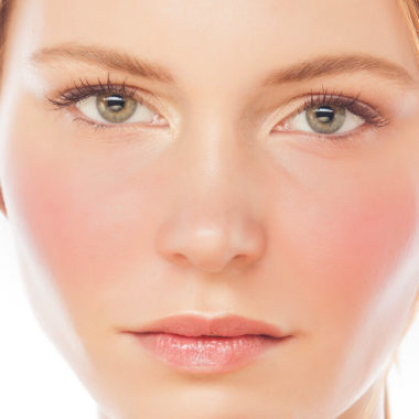 How Do You Get Rid Of Redness On Acne-Prone Face?