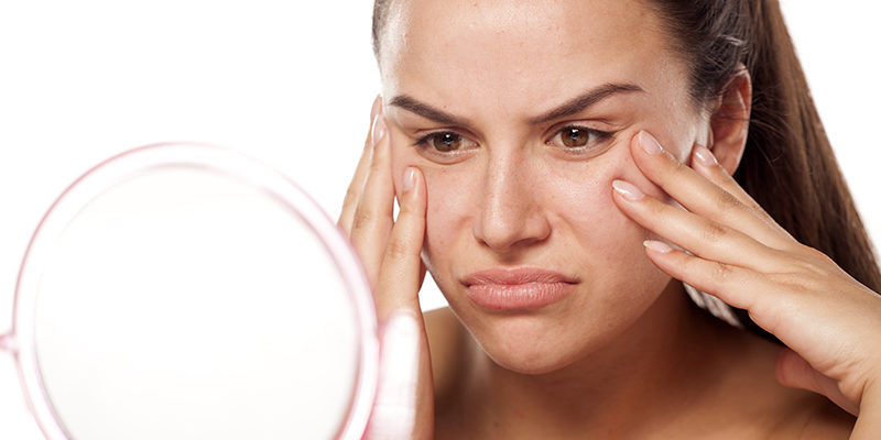 Dead-Skin On Face